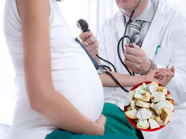 Bà Bầu Ăn Củ Hủ Dừa Được Không? Lợi Ích, Lưu Ý Và Cách Chế Biến Bà Bầu Ăn Củ Hủ Dừa Được Không? Lợi Ích, Lưu Ý Và Cách Chế Biến