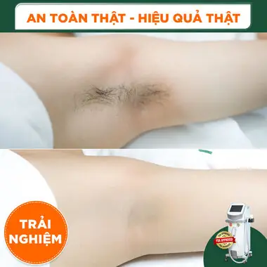 Đậu Đen Ngâm Giấm: Cách Làm, Lợi Ích Sức Khỏe Và Bí Quyết Giảm Cân Đậu Đen Ngâm Giấm: Cách Làm, Lợi Ích Sức Khỏe Và Bí Quyết Giảm Cân