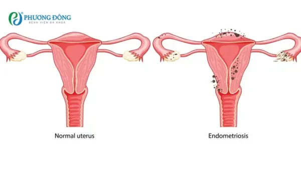 Sau Sinh Có Ăn Được Sắn Dây Luộc Không? Lợi Ích & Lưu Ý Quan Trọng