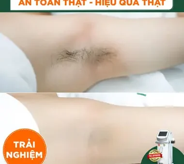 Hướng Dẫn Cách Nấu Yến Mạch Thay Cơm: Từ Cơm Yến Mạch Dẻo Ngon Đến Cháo Mặn Giảm Cân, Chuẩn Dinh Dưỡng